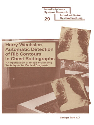 cover image of Automatic Detection of Rib Contours in Chest Radiographs